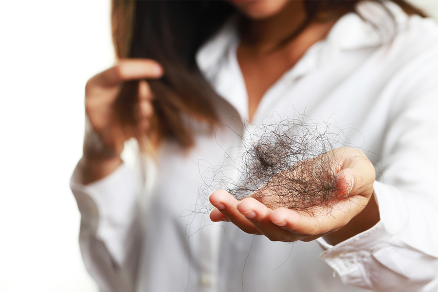 【脫髮原因】染髮過度導致頭髮稀疏？5大女士脫髮原因你要知！